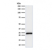 Western blot testing of human HeLa cell lysate with anti-p21 antibody (clone SPM306).