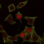Immunofluorescent staining of human HeLa cells with p21 antibody (red, clone CIP1/823) and Phalloiden (green).