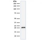 Western blot testing of human HeLa cell lysate with p21 antibody (clone CIP1/823). 