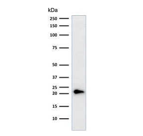 Western blot testing of human HeLa cell lysate with p21 antibody cocktail (clones CIP1/823 + DCS-60.2).~