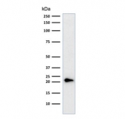Western blot testing of human HeLa cell lysate with p21 antibody cocktail (clones CIP1/823 + DCS-60.2).