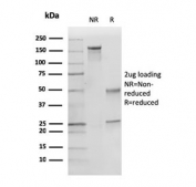 SDS-PAGE analysis of purified, BSA-free p27Kip1 antibody (clone KIP1/769) as confirmation of integrity and purity.