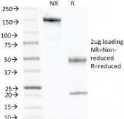 SDS-PAGE Analysis of Purified, BSA-Free p57 Antibody (clone KP10). Confirmation of Integrity and Purity of the Antibody.