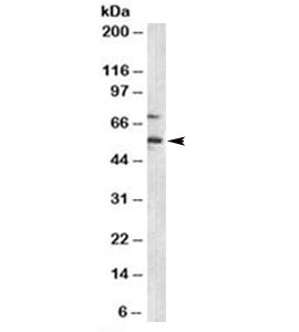 Western blot testing of human Jurkat cell lysate with p57 antibody (clone KP10).