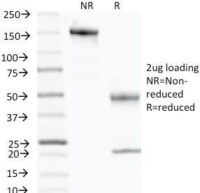 SDS-PAGE Analysis of Purified, BSA-Free p57 Antibody (clone KP10). Confirmation of Integrity and Purity of the Antibody.