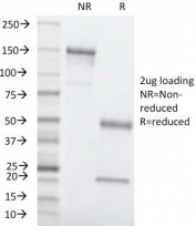 SDS-PAGE Analysis of Purified, BSA-Free CEA Antibody (clone C66/1260). Confirmation of Integrity and Purity of the Antibody.