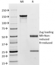 SDS-PAGE Analysis of Purified, BSA-Free CEA Antibody (clone C66/195). Confirmation of Integrity and Purity of the Antibody.