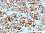 IHC: Formalin-fixed, paraffin-embedded adrenal gland stained with Chromogranin A antibody cocktail (CGA/413 + CHGA/777 + CHGA/798)