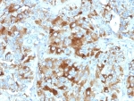 IHC: Formalin-fixed, paraffin-embedded human adrenal gland stained with Chromogranin A antibody (CHGA/765)