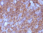 IHC: Formalin-fixed, paraffin-embedded human parathyroid stained with Chromogranin A antibody (CHGA/765)