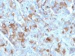 IHC: Formalin-fixed, paraffin-embedded human adrenal gland stained with Chromogranin A antibody (CHGA/777)
