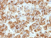 IHC: Formalin-fixed, paraffin-embedded human adrenal gland stained with Chromogranin A antibody (CHGA/798)