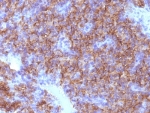 IHC: Formalin-fixed, paraffin-embedded human parathyroid stained with Chromogranin A antibody (CHGA/798)