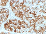 IHC: Formalin-fixed, paraffin-embedded human adrenal gland stained with Chromogranin A antibody (CGA/413)
