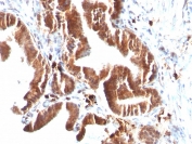 IHC: Formalin-fixed, paraffin-embedded human gallbladder stained with TOP1MT antibody (clone TOP1MT/488).
