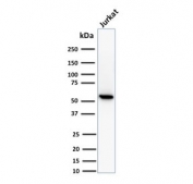 Western blot testing of human Jurkat cell lysate with TOP1MT antibody (clone TOP1MT/488). Predicted molecular weight ~66 kDa.