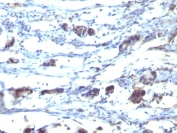 IHC staining of FFPE human stomach with CCR5 antibody (clone 12D1). HIER: boil tissue sections in pH 9 10mM Tris with 1mM EDTA for 20 min and allow to cool before testing.