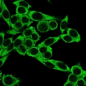 Immunofluorescent staining of PFA-fixed human HeLa cells with CCR5 antibody (clone 12D1).
