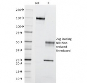 SDS-PAGE analysis of purified, BSA-free CCR5 antibody (clone 12D1) as confirmation of integrity and purity.