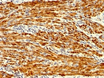 IHC: Formalin-fixed, paraffin-embedded human uterus stained with Calponin antibody (clone SPM169).
