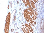 IHC: Formalin-fixed, paraffin-embedded rat uterus stained with anti-Calponin antibody (clone CNN1/832).