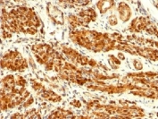 IHC: Formalin-fixed, paraffin-embedded human uterus stained with anti-Calponin antibody (clone CNN1/832).