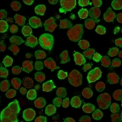 Immunofluorescent staining of PFA-fixed human K562 cells with anti-Calponin antibody (green, clone CNN1/832) and Reddot nuclear stain (red).