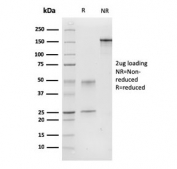 SDS-PAGE analysis of purified, BSA-free Calponin antibody (clone CNN1/832) as confirmation of integrity and purity.