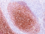 IHC: Formalin-fixed, paraffin-embedded human tonsil stained with CD35 antibody (CR1/802).