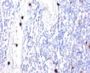 IHC: Formalin-fixed, paraffin-embedded human tonsil stained with G-CSF antibody (CSF3/900). Note specific cytoplasmic staining of granulocytes.