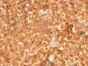 IHC: Formalin-fixed, paraffin-embedded human fetal liver stained with AFP antibody (C2 + C3 + MBS-12).
