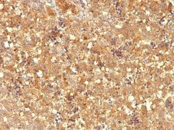 IHC: Formalin-fixed, paraffin-embedded human fetal liver stained with AFP antibody (MBS-12).~