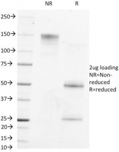 SDS-PAGE Analysis of Purified, BSA-Free AFP Antibody (clone MBS-12). Confirmation of Integrity and Purity of the Antibody.