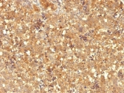 IHC: Formalin-fixed, paraffin-embedded human fetal liver stained with AFP antibody (MBS-12).