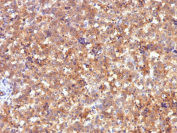 Alpha Fetoprotein Antibody Fetal Liver Immunohistochemistry. IHC analysis of formalin-fixed, paraffin-embedded human fetal liver with Alpha Fetoprotein antibody (clone C2).