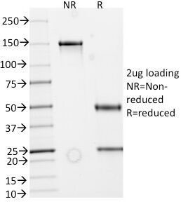 SDS-PAGE Analysis of Purified, BSA-Free recombinant Secretory Component Glycoprotein Antibody (