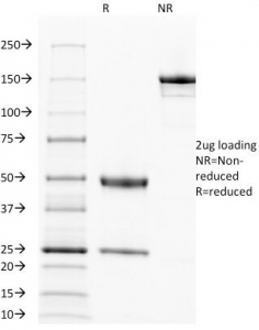 SDS-PAGE Analysis of Purified, BSA-Free EGFR Antibody (clone 31G7). Confirmation of Integrity and Purity of the Antibody.