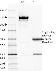 SDS-PAGE analysis of purified, BSA-free EGFR antibody (clone GFR1195) as confirmation of integrity and purity.