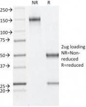 SDS-PAGE Analysis of Purified, BSA-Free Estrogen Receptor beta Antibody (clone ESR2/686). Confirmation of Integrity and Purity of the Antibody.