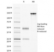 SDS-PAGE Analysis of Purified, BSA-Free CD32 Antibody (clone 8.7). Confirmation of Integrity and Purity of the Antibody.