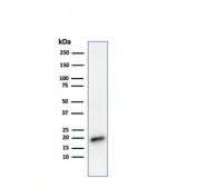 Western blot testing of human COLO-38 cell lysate with Melan-A antibody (clone MLANA/788). Expected molecular weight ~20 kDa with possible doublet.