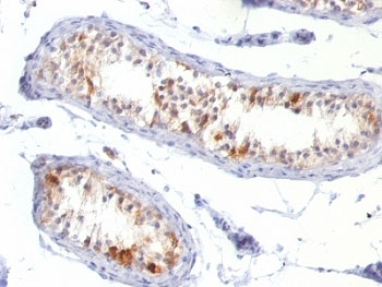 IHC: Formalin-fixed, paraffin-embedded human testis stained with Melan-A antibody (MLANA/788).~