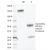 SDS-PAGE Analysis of Purified, BSA-Free CELA3B Antibody (clone CELA3B/1218). Confirmation of Integrity and Purity of the Antibody.