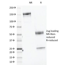 SDS-PAGE Analysis of Purified, BSA-Free CELA3B Antibody (clone CELA3B/1218). Co
