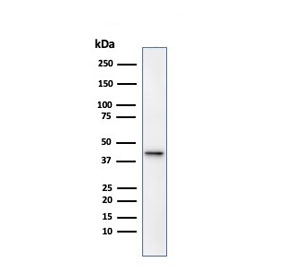 Western blot testing of human kidney lysate with AMACR antibody. Predicted molecular weight ~43 kDa.