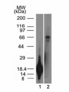 Western blot testing of a 1) partial recombinant protein and 2) A431 cell lysate using TRIM29 antibody (clone TRIM29/1042). Predicted molecular weight ~66 kDa.~
