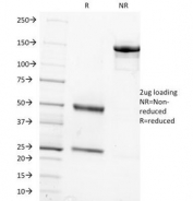 SDS-PAGE Analysis of Purified, BSA-Free FSH-beta Antibody (clone FSHb/1062). Confirmation of Integrity and Purity of the Antibody.