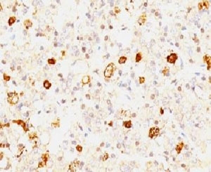IHC: Formalin-fixed, paraffin-embedded human pituitary stained with FSH-beta antibody (clone FSHb/1062).~
