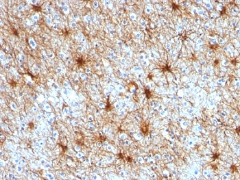 IHC: Formalin-fixed, paraffin-embedded human cerebellum stained with GFAP antibody (ASTRO/789).~
