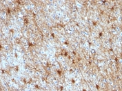 IHC: Formalin-fixed, paraffin-embedded human cerebellum stained with GFAP antibody cocktail (GA-5 + ASTRO/789).